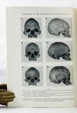 The Craniology of the Aborigines of Queensland