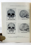 The Craniology of the Aborigines of Coastal New South Wales