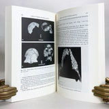 A Theory of Human and Primate Evolution
