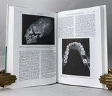 Skeleton Keys: An Introduction to Human Skeletal Morphology, Development, and Analysis