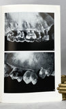 Morphogenetical Aspects of the Human Upper Molar: A comparative study of its enamel and dentine surfaces and their relationship to the crown pattern of fossil and recent primates